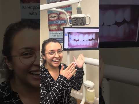 Patient Testimonial: Invisalign Treatment | DrJohnsonDDS.com