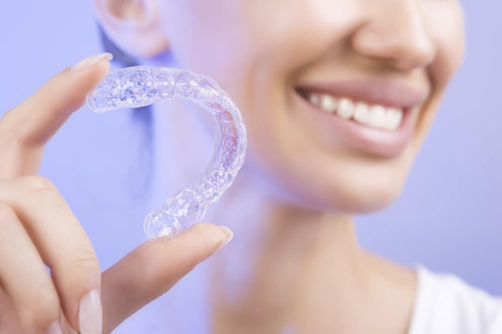 Invisalign special