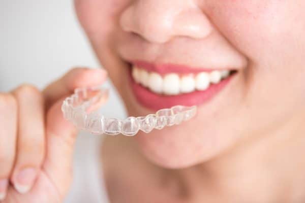 Invisalign cost