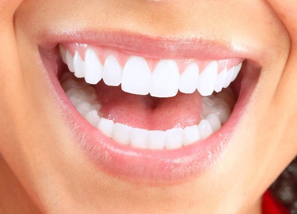 porcelain veneers cost