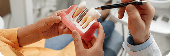 Explaining the benefits of dental implants using a tooth model