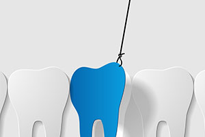 Illustration of a tooth being extracted.